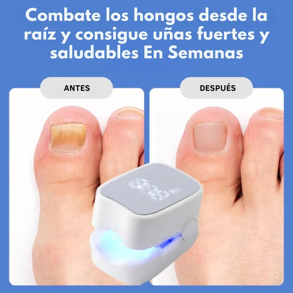 NailDerm Pro