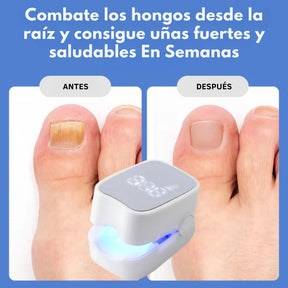 NailDerm Pro