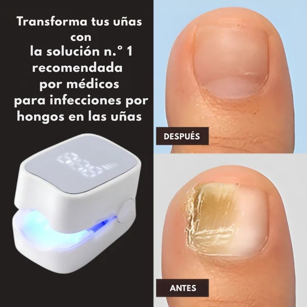 NailDerm Pro