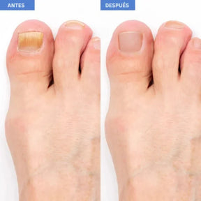 NailDerm Pro